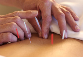 Five Element Acupuncture