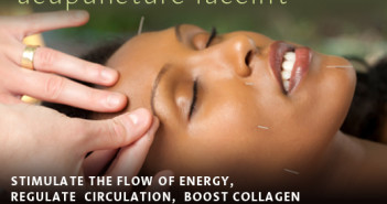 Acupuncture Facelift