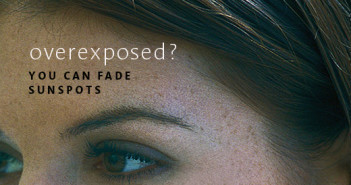 TIPS FOR PREVENTING REPAIRING SUN SPOTS