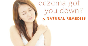 treatment for eczema
